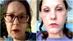 TikTok in de ban van “de beste facelift ooit”